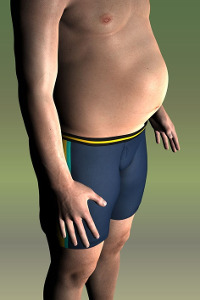 Obesidade Masculina